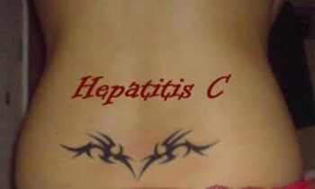 Hepatitis C na een tatoeage