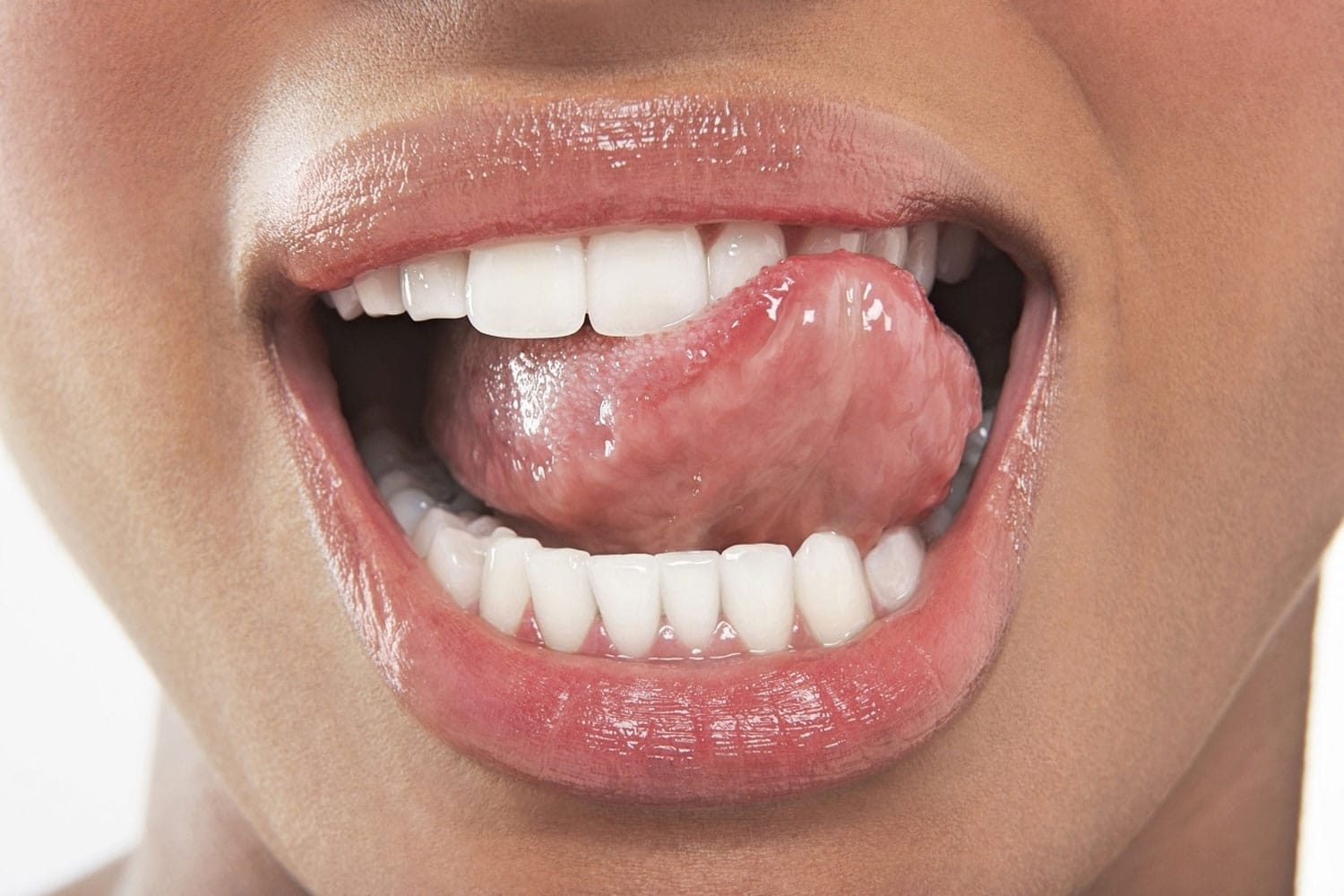 Neem de telefoon op schoolbord Speels Glossodynie: een pijnlijk en branderig gevoel in je mond - Dokter.nl