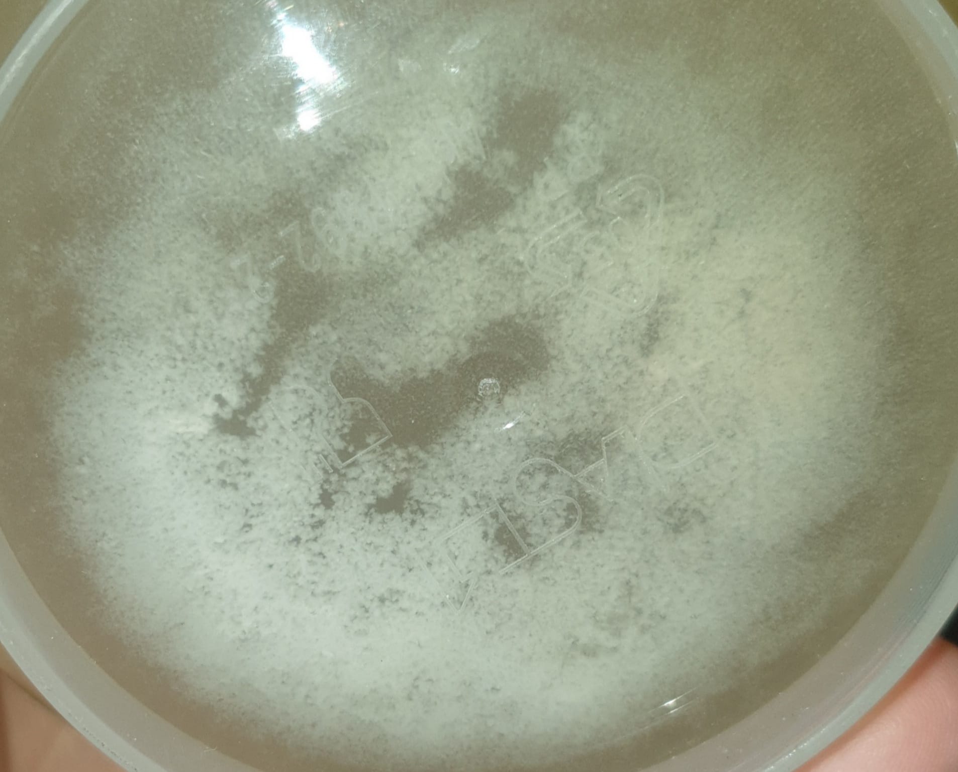 How much foam in urine is normal