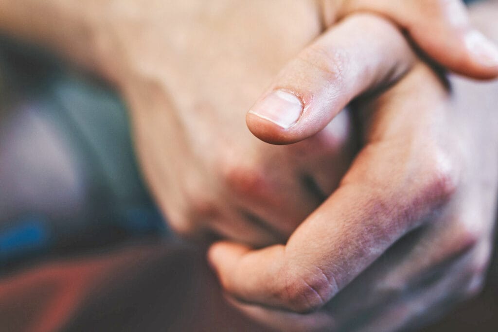 Groeven in je nagels? Dit zijn mogelijke oorzaken