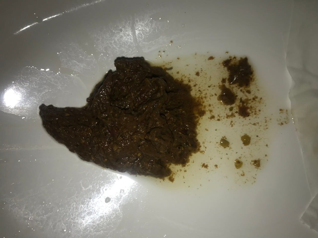 Ontlasting met witte stukjes - Medische Forum - Dokter.nl