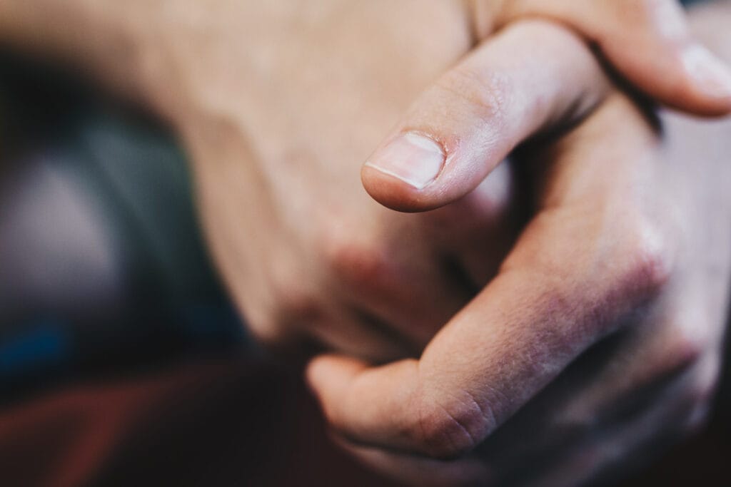 Geribbelde nagels: wat veroorzaakt het?