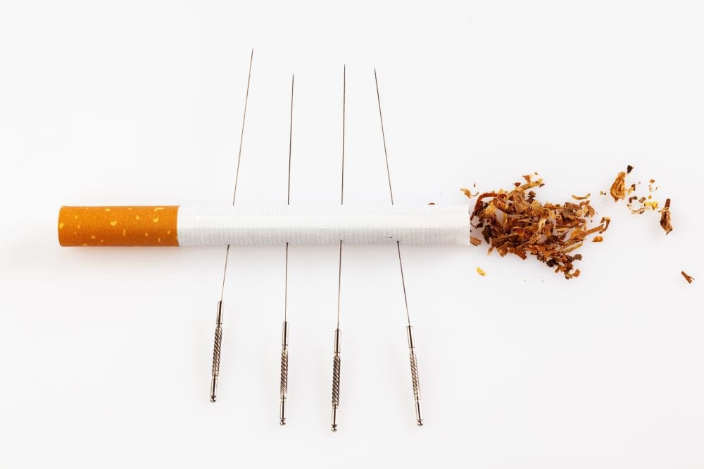 acupunctuur bij stoppen met roken