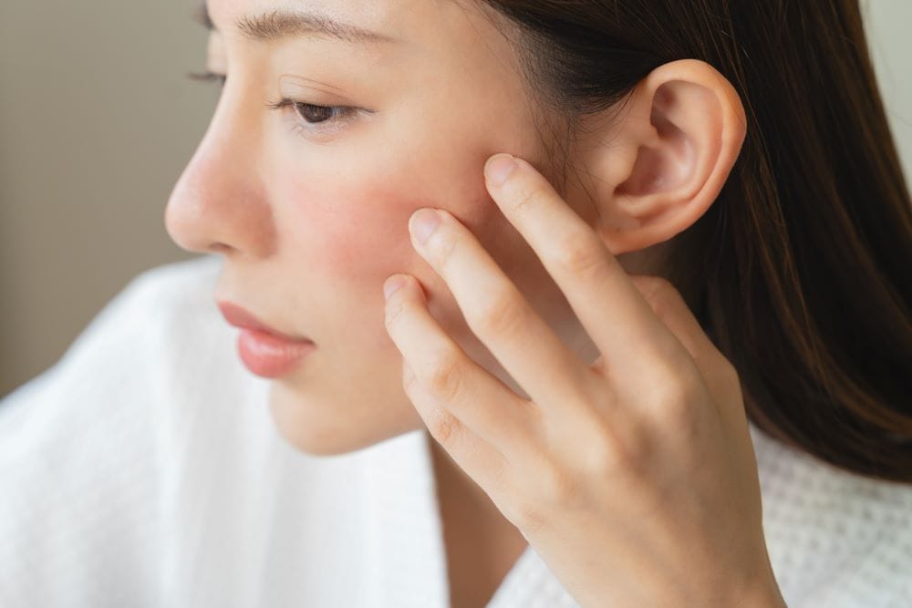 contactallergie gezicht